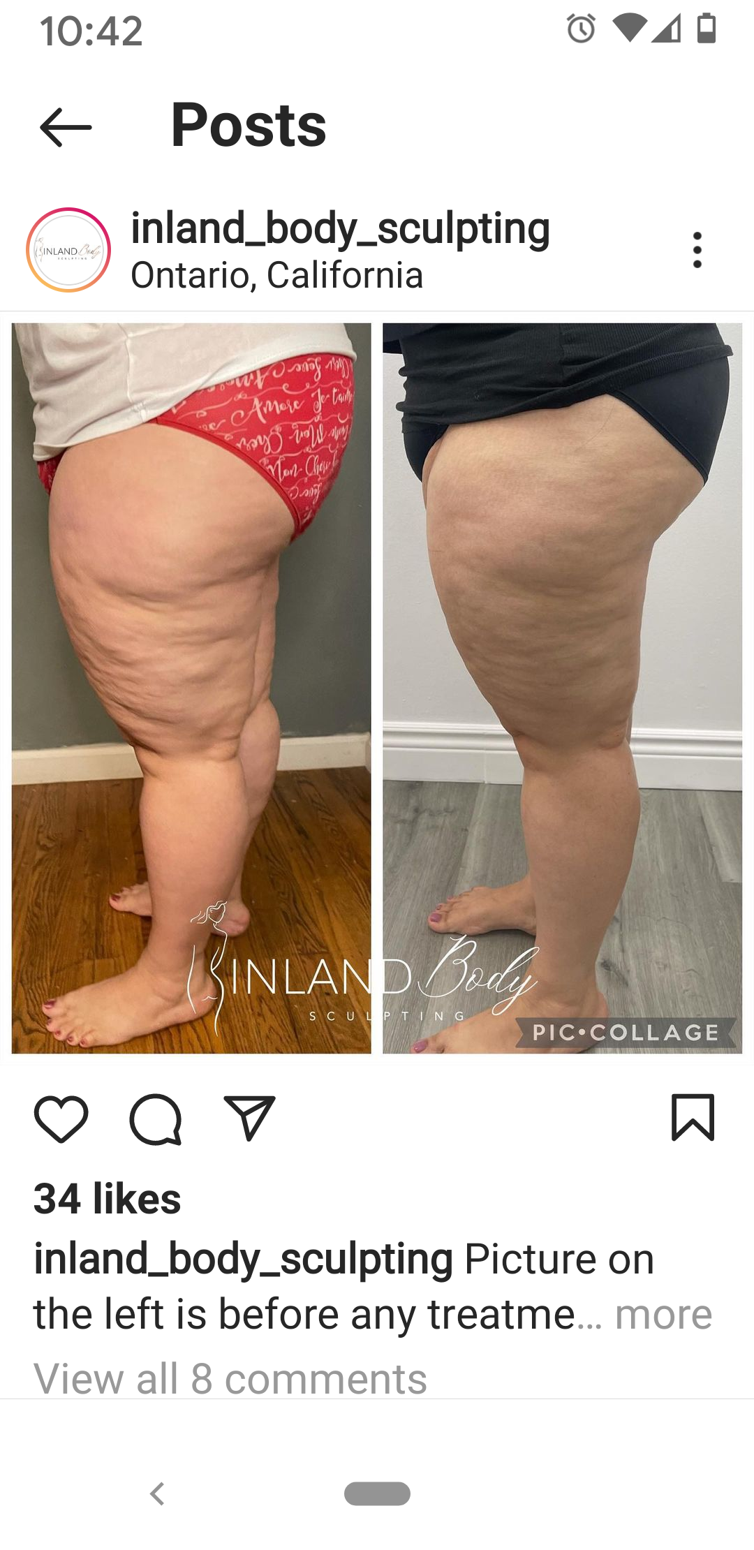 Inland Body Sculpting In Ontario CA